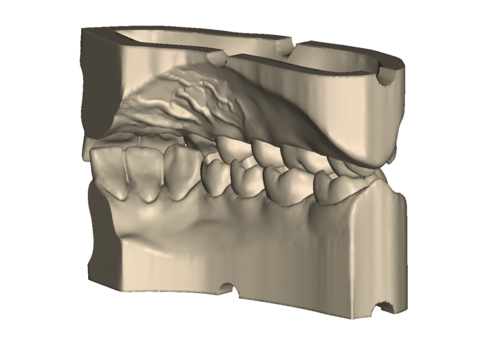 	Dental Practice Model Kit 3D Print 554528