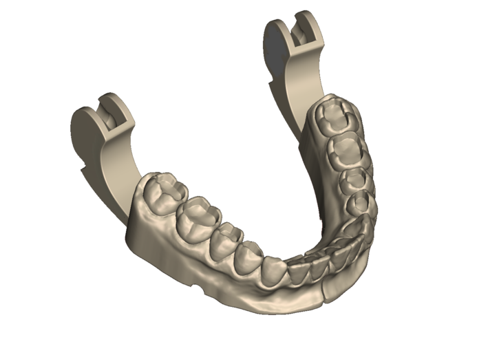 	Dental Practice Model Kit 3D Print 554530