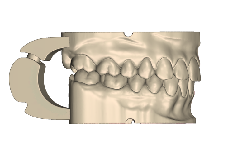 	Dental Practice Model Kit 3D Print 554531