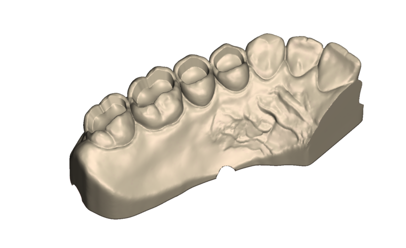 	Dental Practice Model Kit 3D Print 554534