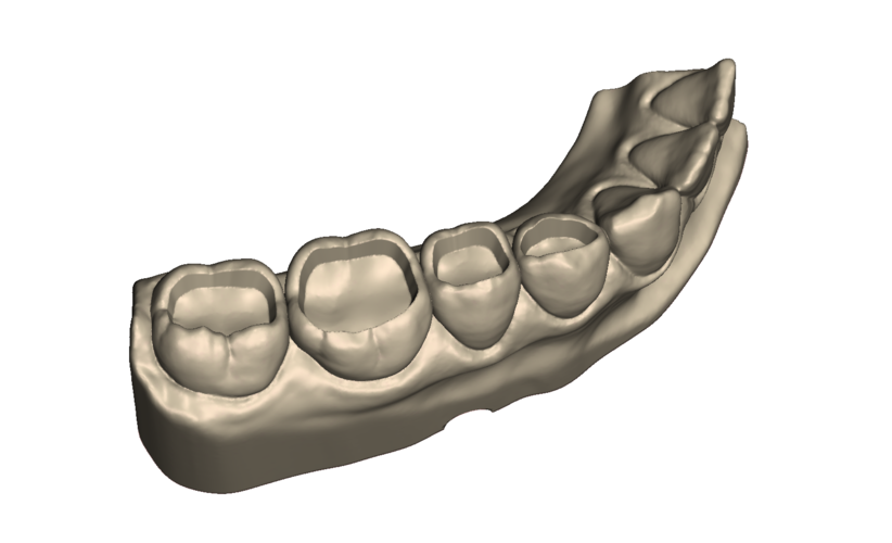 	Dental Practice Model Kit 3D Print 554535