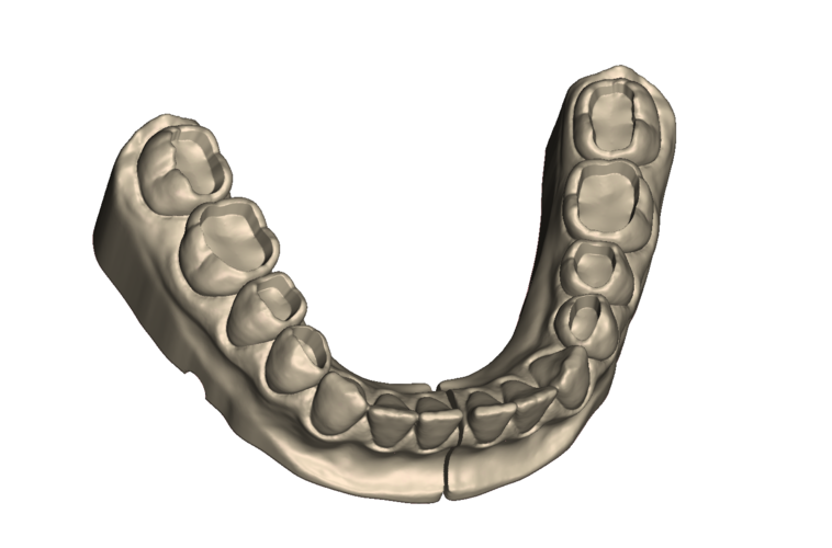 	Dental Practice Model Kit 3D Print 554537