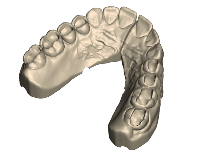 	Dental Practice Model Kit 3D Print 554538