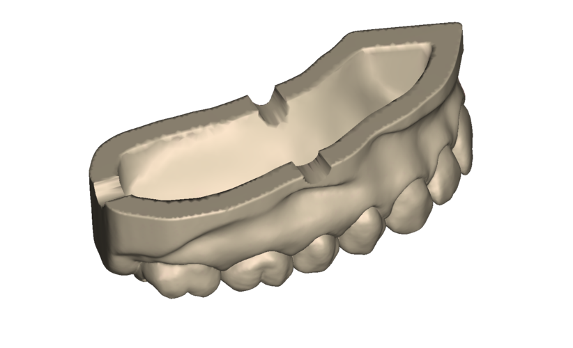 	Dental Practice Model Kit 3D Print 554539