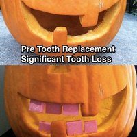 Pumpkin Tooth Replacement Project - Thumbnail 2