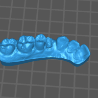 2-Unit Dental Bridge Design - Thumbnail 2