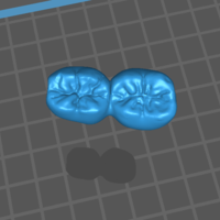 2-Unit Dental Bridge Design - Thumbnail 4