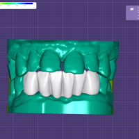 Precision Dental Bridge – CNC & 3D Print Ready - Thumbnail 3