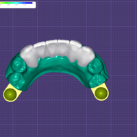 Precision Dental Bridge – CNC & 3D Print Ready - Thumbnail 4