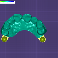 Precision Dental Bridge – CNC & 3D Print Ready - Thumbnail 5
