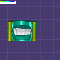 Precision Dental Bridge – CNC & 3D Print Ready - Thumbnail 7