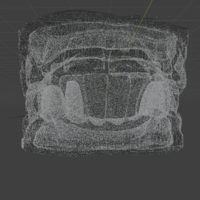 Precision Dental Bridge – CNC & 3D Print Ready - Thumbnail 8