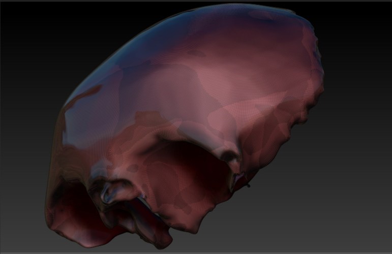 Human Frontal Bone 3D Print 62015