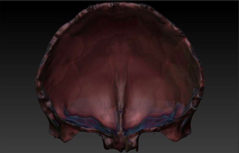 Human Frontal Bone 3D Print 62017