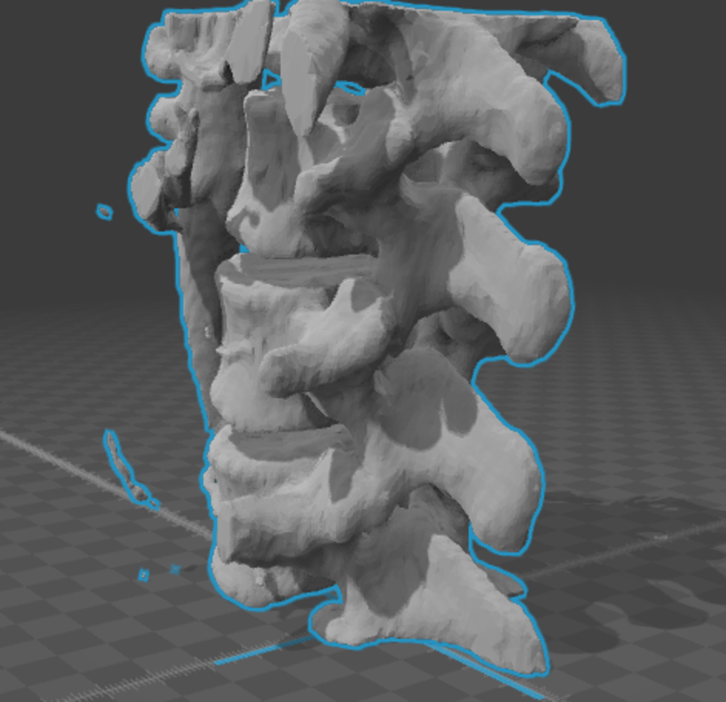 Vertebral Column