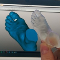 Scanned Foot - Thumbnail 4