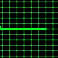 EKG_heartbeat - Thumbnail 2