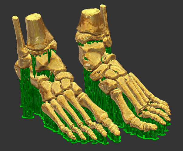 foot bone 3D Print 94998
