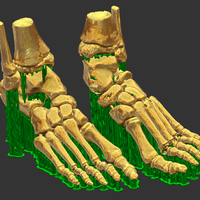 foot bone - Thumbnail 4