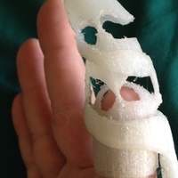 prosthetic finger - Thumbnail 1