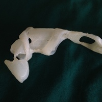 prosthetic finger - Thumbnail 4