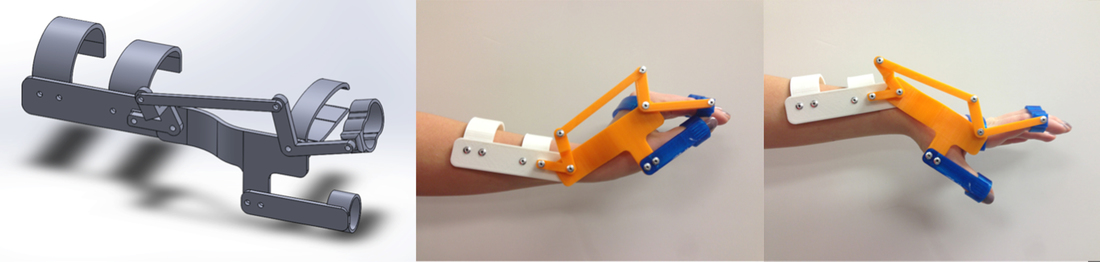 3D-Printed Wrist-Driven Orthosis (WDO) 3D Print 97987