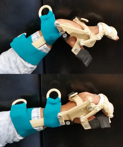 3D-Printed Wrist-Driven Orthosis (WDO) 3D Print 97990