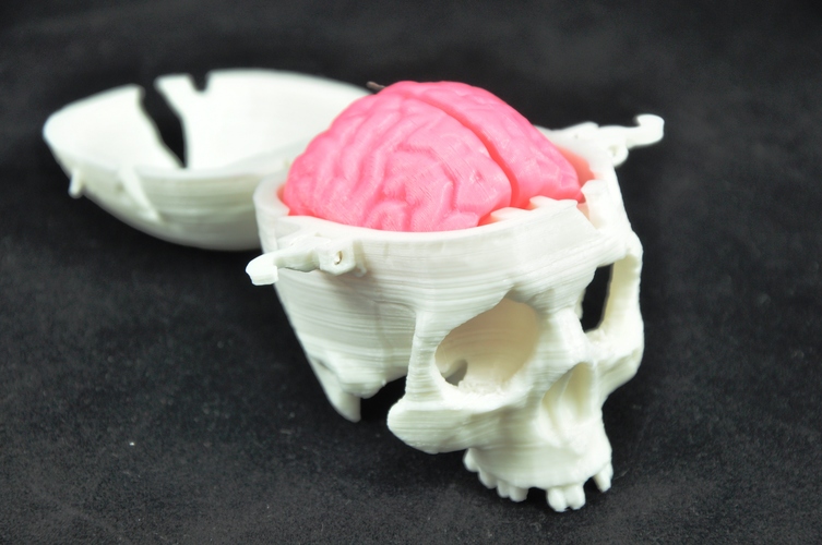 Boneheads: Skull Box w/ Brain - via 3DKitbash.com 3D Print 12468