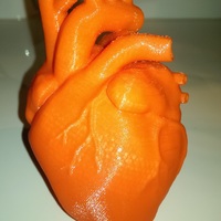 Small Anatomical Heart 3D Printing 15187