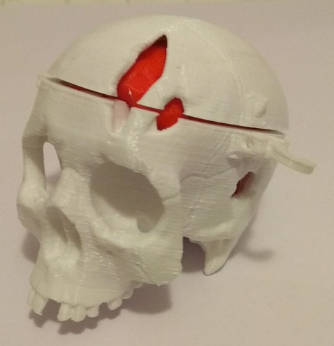 Boneheads: Skull Box w/ Brain - via 3DKitbash.com 3D Print 25060