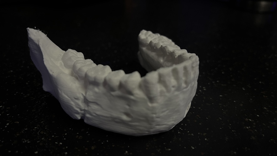 Homo Naledi Skull Reconstruction - Lower Face 3D Print 45824