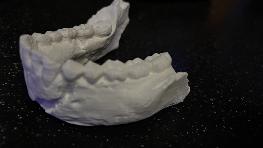 Homo Naledi Skull Reconstruction - Lower Face 3D Print 45825