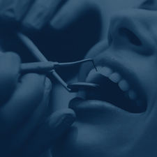 Urfa implant